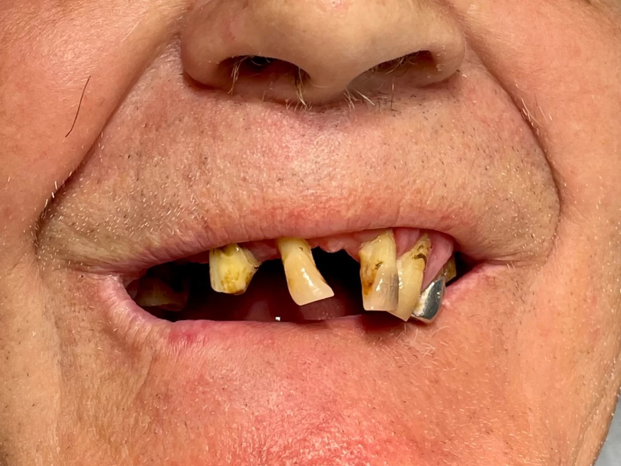 Clinica Teodent - Implant Dentar Fast & Fixed