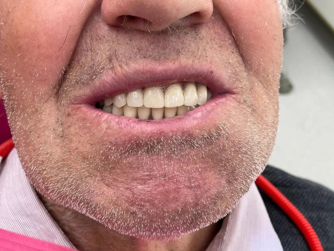 Clinica Teodent - Implant Dentar Fast & Fixed